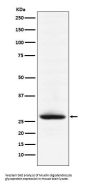 Anti-Myelin oligodendrocyte glycoprotein Monoclonal Antibody