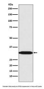 Anti-REA Rabbit Monoclonal Antibody