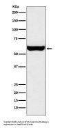 Anti-Monoamine Oxidase A Rabbit Monoclonal Antibody