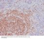 Anti-SHIP INPP5D Rabbit Monoclonal Antibody
