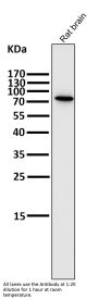 Anti-PI 3 Kinase p85 beta PIK3R2 Rabbit Monoclonal Antibody