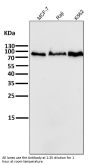 Anti-PI 3 Kinase p85 beta PIK3R2 Rabbit Monoclonal Antibody