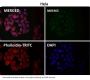 Anti-PI 3 Kinase p85 beta PIK3R2 Rabbit Monoclonal Antibody