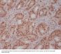 Anti-PI 3 Kinase p85 beta PIK3R2 Rabbit Monoclonal Antibody