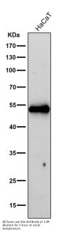 Anti-Cytokeratin 16 KRT16 Rabbit Monoclonal Antibody
