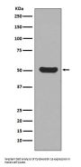 Anti-Cytokeratin 16 KRT16 Rabbit Monoclonal Antibody