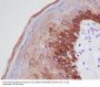 Anti-Cytokeratin 16 KRT16 Rabbit Monoclonal Antibody