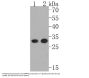 Anti-DARPP32 PPP1R1B Rabbit Monoclonal Antibody