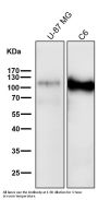 Anti-ApoER2 Monoclonal Antibody
