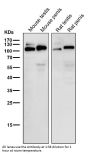 Anti-ApoER2 Monoclonal Antibody