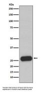 Anti-Mast Cell Chymase Rabbit Monoclonal Antibody