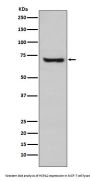 Anti-HSPA2 Rabbit Monoclonal Antibody