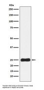Anti-Casein Kinase 2 beta Monoclonal Antibody