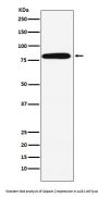 Anti-Calpain 2 Rabbit Monoclonal Antibody