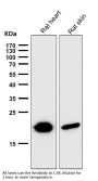 Anti-CRYAB/Alpha B Crystallin Rabbit Monoclonal Antibody