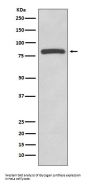 Anti-Glycogen synthase GYS1 Rabbit Monoclonal Antibody