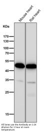 Anti-CCR8 Rabbit Monoclonal Antibody