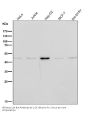 Anti-CCR8 Rabbit Monoclonal Antibody