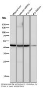 Anti-CCR8 Rabbit Monoclonal Antibody