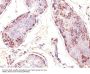 Anti-MAGE-1 (Target for Cancer Immunotherapy) Monoclonal Antibody