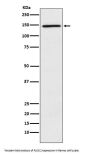 Anti-PLCG2 Rabbit Monoclonal Antibody