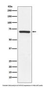 Anti-MEKK3 MAP3K3 Rabbit Monoclonal Antibody