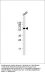 Anti-Natriuretic Peptide Receptor C Antibody