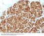 Anti-MAML2 (Mastermind Like Transcriptional Coactivator 2) Monoclonal Antibody