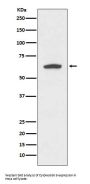 Anti-Cytokeratin 9 KRT9 Rabbit Monoclonal Antibody
