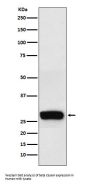 Anti-beta Casein Rabbit Monoclonal Antibody