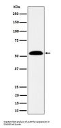 Anti-ALDH7A1 Rabbit Monoclonal Antibody