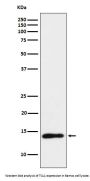 Anti-TCL1 Monoclonal Antibody