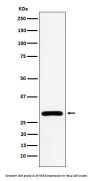 Anti-NEK6 Rabbit Monoclonal Antibody