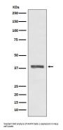 Anti-AMPK beta 1 PRKAB1 Rabbit Monoclonal Antibody