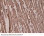 Anti-Alpha Cardiac Actin (ACTC1) Rabbit Monoclonal Antibody, Clone#RM257