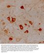 Anti- Alpha-internexin/NF66 Monoclonal Antibody