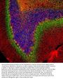 Anti- Alpha-internexin INA NF66 Antibody