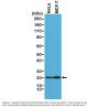 Anti-Smac/Diablo Rabbit Monoclonal Antibody, Clone#RM271