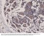 Anti-Smac/Diablo Rabbit Monoclonal Antibody, Clone#RM271
