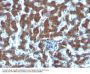 Anti-Retinol Binding Protein-1 (RBP1) RBP4 Monoclonal Antibody