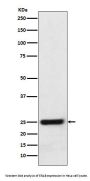 Anti-ERAB Monoclonal Antibody