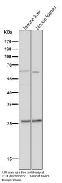 Anti-BCL2A1/Bcl 2 Related Protein A1 Rabbit Monoclonal Antibody