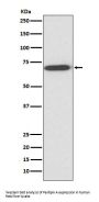 Anti-Perilipin A PLIN1 Rabbit Monoclonal Antibody