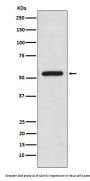 Anti-CaMKII Monoclonal Antibody