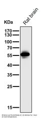 Anti-CaMKII CAMK2B Rabbit Monoclonal Antibody