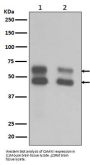 Anti-CaMKII CAMK2B Rabbit Monoclonal Antibody