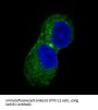 Anti-CaMKII CAMK2B Rabbit Monoclonal Antibody