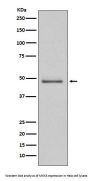Anti-MEK5 Rabbit Monoclonal Antibody