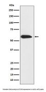 Anti-Cytokeratin 6 Rabbit Monoclonal Antibody