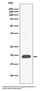 Anti-Myoglobin MB Rabbit Monoclonal Antibody